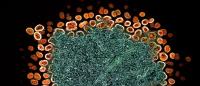 HIV particles surrounding a human T cell